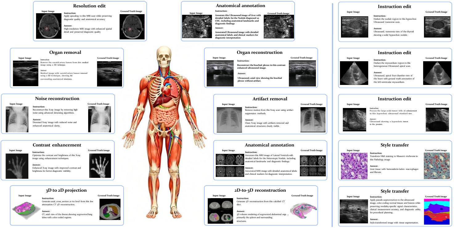 Representative MedGEN-Bench task cards arranged around an anatomical figure, spanning restoration, organ manipulation, cross-dimensional reconstruction, anatomical annotation, instruction-guided editing, and style transfer.